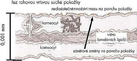 řez suchou položkou